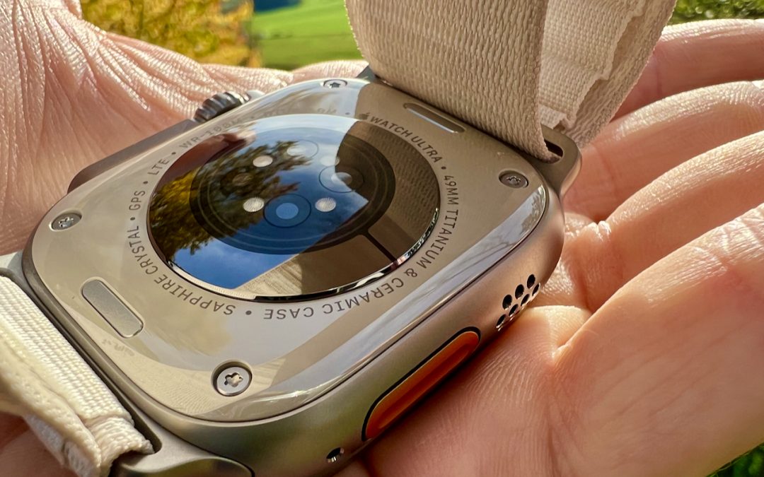 Wie sinnvoll ist die Apple Watch?